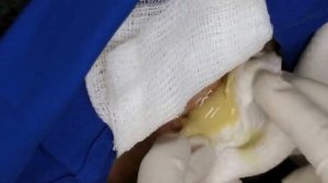 Most DISGUSTING Moments on Dr. Pimple Popper that made us SHUDDER (Part 12)