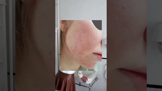 Не смывать макияж перед сном? Так делать НЕ надо! смотреть онлайн