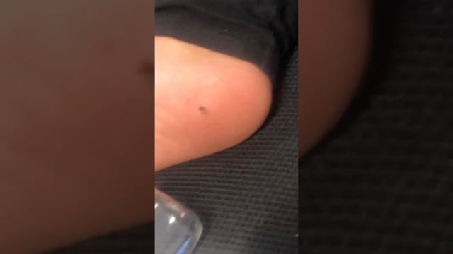 ~ HUGE SPLINTER ~ 8 year old pulls GIANT splinter from foot!! смотреть онлайн