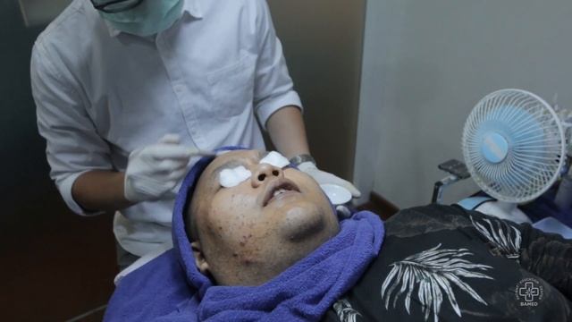 Pimple Popper Session feat Reza Chandika | Bamed Vlog смотреть онлайн