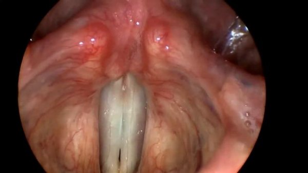 Whistle Register   Свистковый регистр