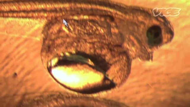 New York's Toxic Wasteland: America's Water Crisis (Part 1/3) смотреть онлайн