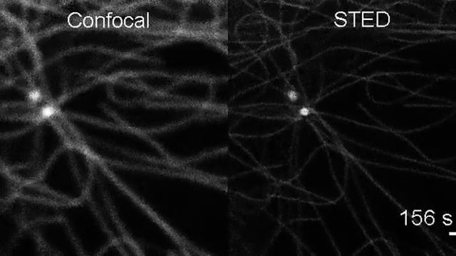 Confocal and STED microscopy comparative o timecourse of stained tubulin in a living fibroblast. смотреть онлайн