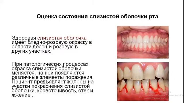 Основы пропедевтики в стоматологии смотреть онлайн