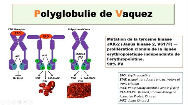 🔴Hématologie: Les Syndromes Myéloprolifératifs смотреть онлайн