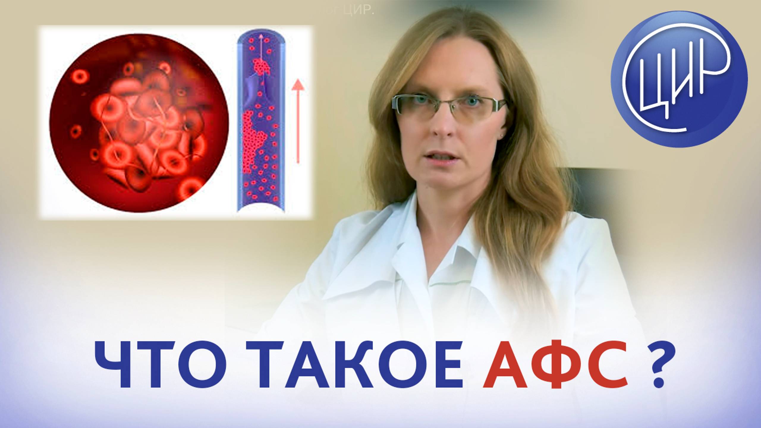 Антифосфолипидный синдром. Что такое АФС. Дрожжина А.И. смотреть онлайн