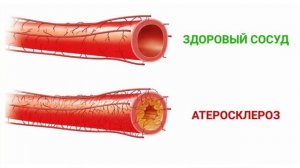 #ЧЕСНОК фойдаси ва зарари, албатта КУРИНГ.