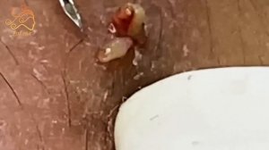 Enjoy Every Day With The Best Video Loan Nguyen 2022 #8014