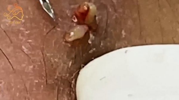 Enjoy Every Day With The Best Video Loan Nguyen 2022 #8014