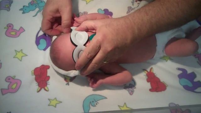 The Inservice for the Patented Bili Bonnet Phototherapy mask смотреть онлайн