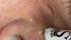 Satisfying Relaxing with Sac Dep Spa Video (#132)