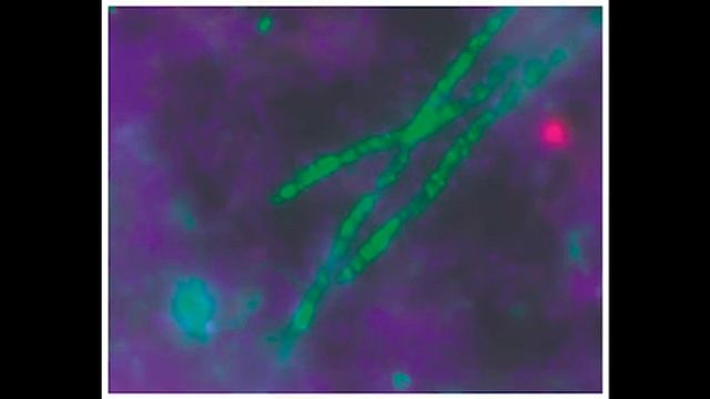 Acidobacteria и Verrucomicrobia смотреть онлайн
