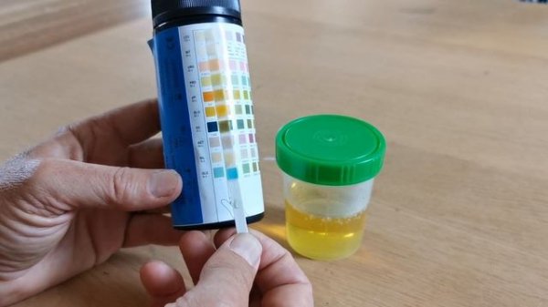 How to use urine test strips 10 parameters