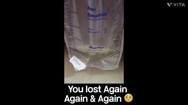 You lost Again & Again Until I Win 😔😔 My Story of Last Year 🥺💔 смотреть онлайн