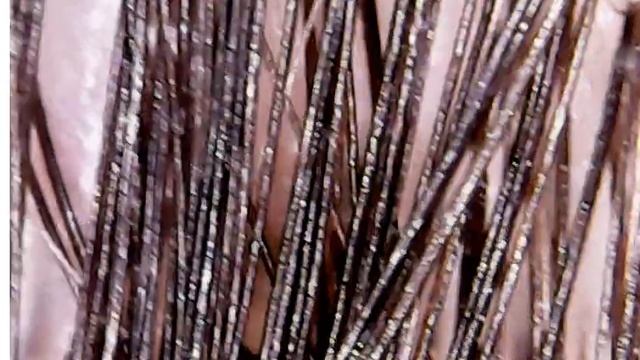 hair and head skin under microscope смотреть онлайн