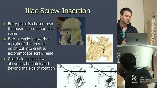 Sacral and Pelvic Fixation - Tyler Koski, MD смотреть онлайн