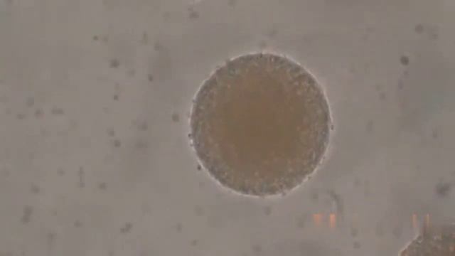 Sperm and egg fertilization under the microscope (Zoom×1000) #science #fertilization #sperm смотреть онлайн