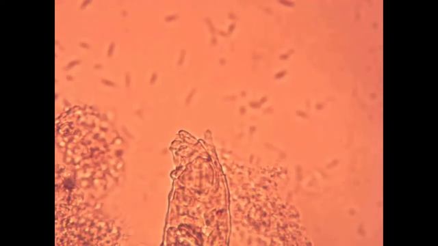 Microscope: Rotifers nemotodes and others смотреть онлайн