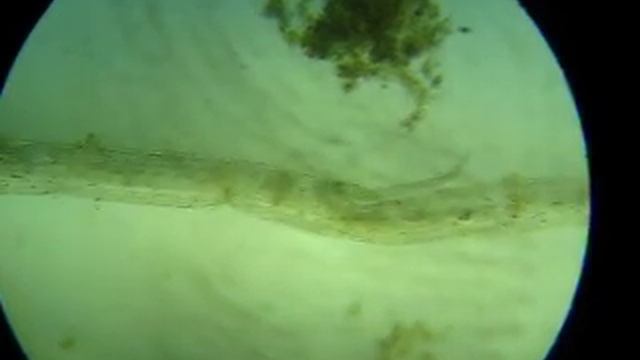 простейшие в аквариумной воде 1 смотреть онлайн