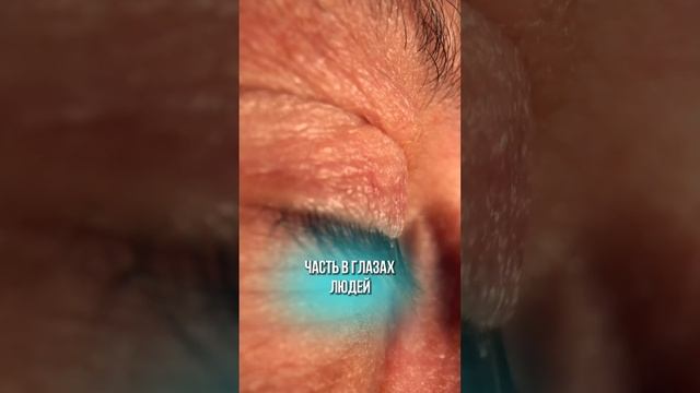 ПРО ОПЕРАЦИИ НА ГЛАЗАХ смотреть онлайн