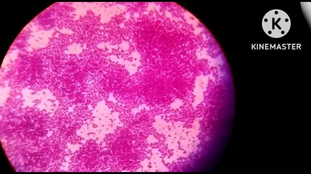 Staphylococcus aureus (gram positive bacteria) under the microscope 100x... are seen!! смотреть онлайн