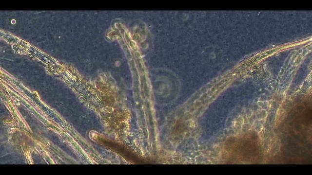 Хилодонеллы + грибок + бактерии / Hilodonella + fungus + bacteria. Фазовый контраст. смотреть онлайн