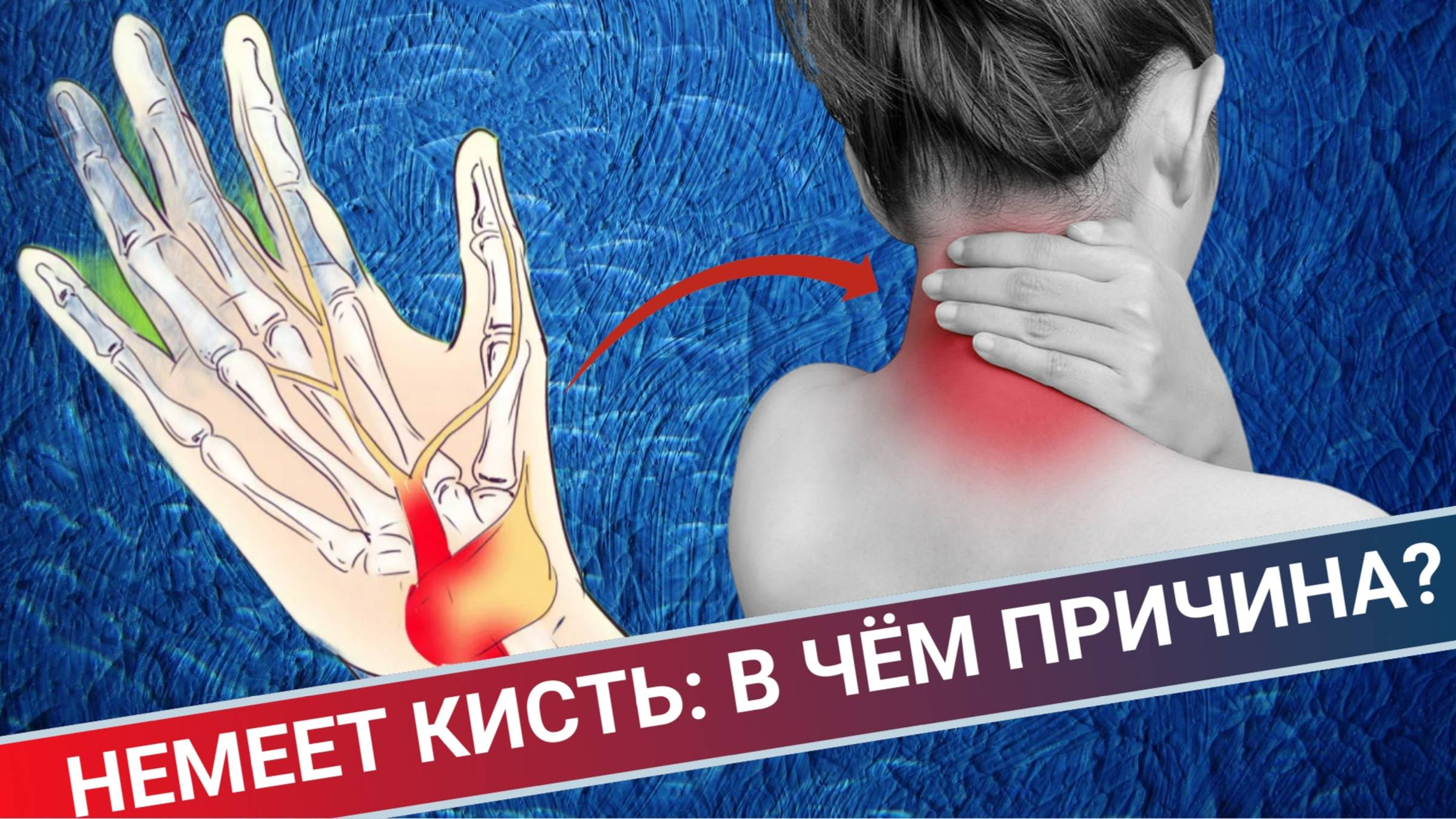 НЕМЕЕТ КИСТЬ. СРАВНЕНИЕ ДВУХ СЛУЧАЕВ смотреть онлайн