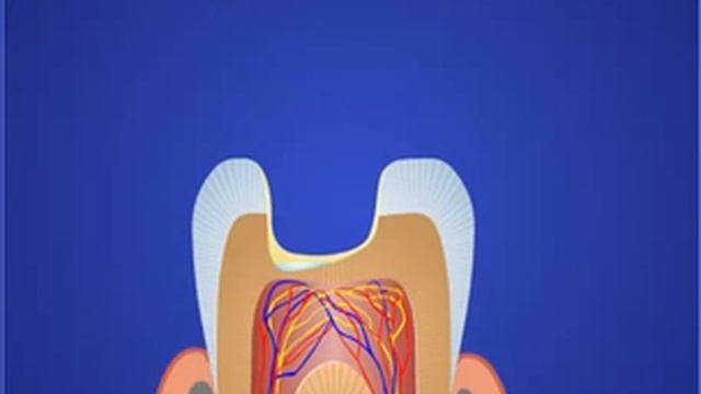 Лечение глубокого кариеса смотреть онлайн