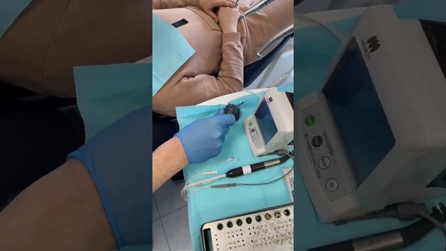 Как выглядит пломбирование каналов зуба? Заглянули на прием к терапевту- эндодонтисту! смотреть онлайн