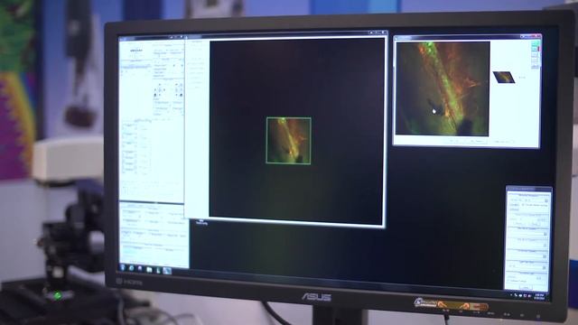Opterra High-Speed Live Cell Imaging Multipoint Scanning Confocal Microscope смотреть онлайн