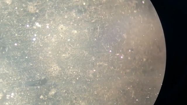 Leptospira motility under microscope.#Leptospira#MLS#Medilabacademy#Leptospirosis смотреть онлайн