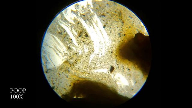 POOP UNDER MICROSCOPE - 100X 250X 1000X 4K смотреть онлайн