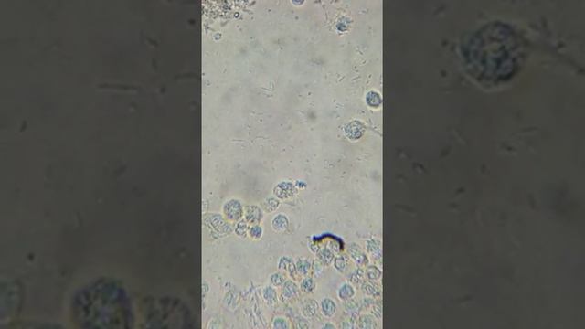 🔬 Urine Pus Cells with Bacteria under 45x microscope смотреть онлайн
