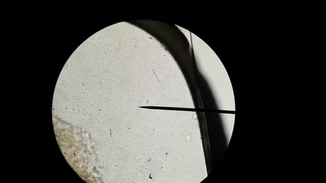 Costia at 40x, 100x, and 400x magnification смотреть онлайн
