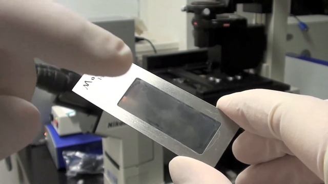 Lasers, Hepatitis C Virus and Human Genetics смотреть онлайн