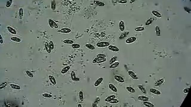 Under Microscope: Infusoria: Fantastic Small Creatures Swimming in Water Drop смотреть онлайн