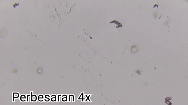 Zoom Kecap Di Mikroskop!!! Banyak Yang Gerak?!!!