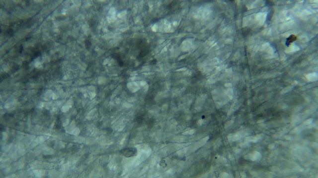 Pictures Taken With Bresser LCD Mikroskope