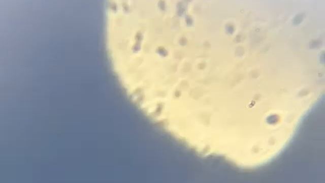 Saliva under a webcam microscope смотреть онлайн