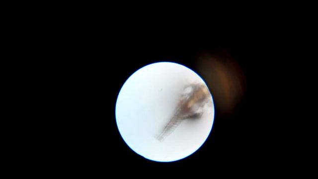 Аква дракон, день 11, под микроскопом с х60. смотреть онлайн