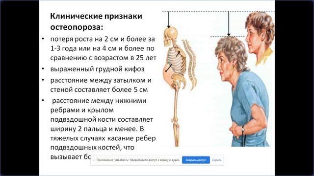 Диспансеризация 65+ смотреть онлайн