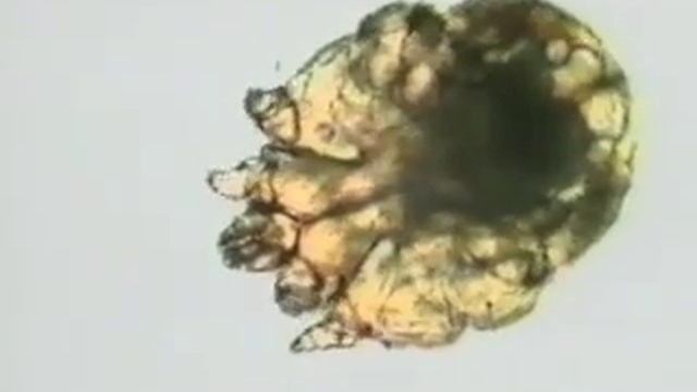ScabiesM under a Microscope смотреть онлайн