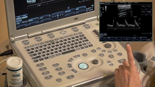 Mindray M7 Training   Pulse Wave Doppler
