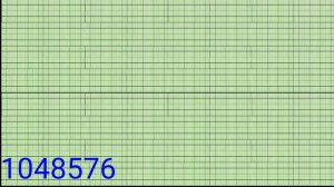 Windows Vista Beta 1 Huyen Chi edition startup sound (high pitch) - 1099511627776 times