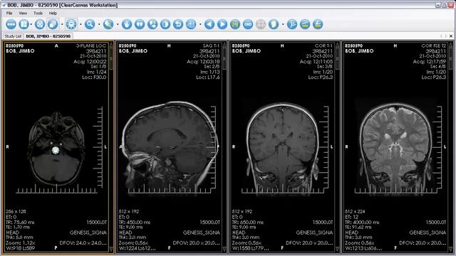 ClearCanvas Workstation Portable Edition