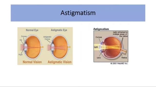 Common Eye Ailments and Eye Defects I Proper Care for the Eyes I Teacher Hiezel смотреть онлайн