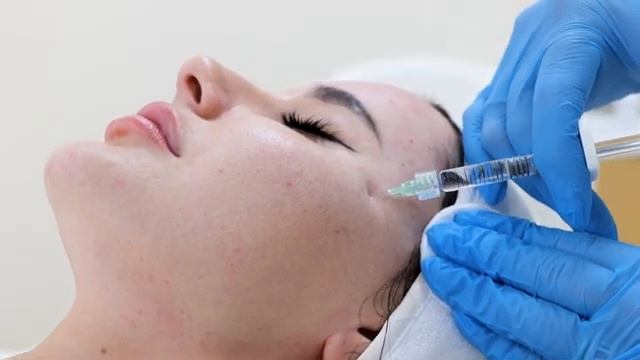 Моделирование лица без операции: инъекционная контурная пластика смотреть онлайн