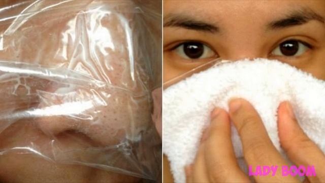 ВАЗЕЛИН уберет ЧЕРНЫЕ ТОЧКИ на Носу. Чистка лица дома смотреть онлайн