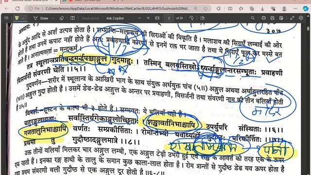 SUSHRUTA NIDAN 2 ( ARSH )(PILES) AYURVEDA ( DR RAVI ACCHDANI ) смотреть онлайн