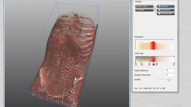 3D Tomography (human body, x-ray tomography) смотреть онлайн
